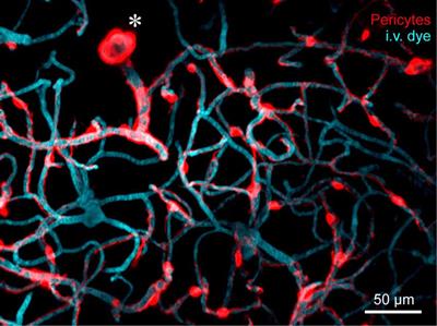 Pericyte Structural Remodeling in Cerebrovascular Health and Homeostasis